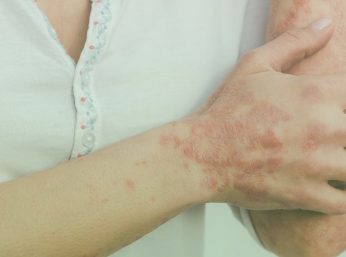BỆNH TỰ MIỄN & NHỮNG ĐIỀU CẦN BIẾT