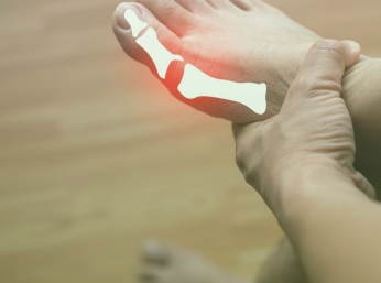 NHỮNG ĐIỀU CẦN BIẾT VỀ BỆNH GOUT - 'CĂN BỆNH NHÀ GIÀU'
